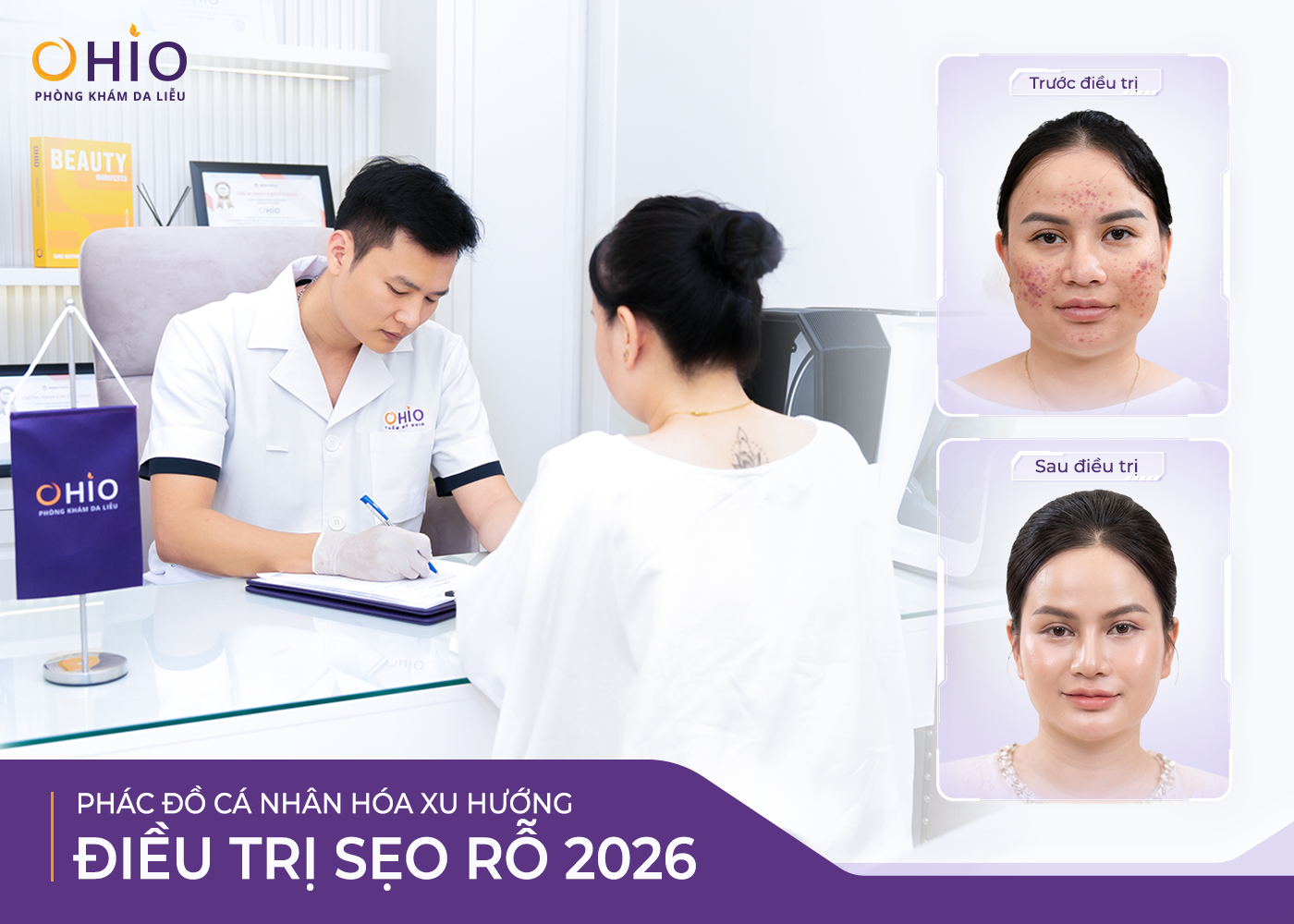 OHIO Và Hướng Đi Mới Trong Điều Trị Sẹo Rỗ: Không Chỉ Làm Đầy Sẹo, Mà Tái Sinh Sự Tự Tin - Phòng khám da liễu OHIO OHIO Và Hướng Đi Mới Trong Điều Trị Sẹo Rỗ: Không Chỉ Làm Đầy Sẹo, Mà Tái Sinh Sự Tự Tin