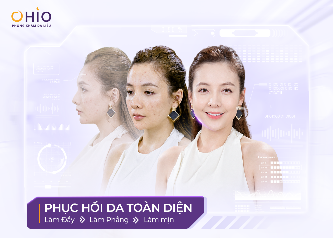 OHIO Và Hướng Đi Mới Trong Điều Trị Sẹo Rỗ: Không Chỉ Làm Đầy Sẹo, Mà Tái Sinh Sự Tự Tin - Phòng khám da liễu OHIO OHIO Và Hướng Đi Mới Trong Điều Trị Sẹo Rỗ: Không Chỉ Làm Đầy Sẹo, Mà Tái Sinh Sự Tự Tin