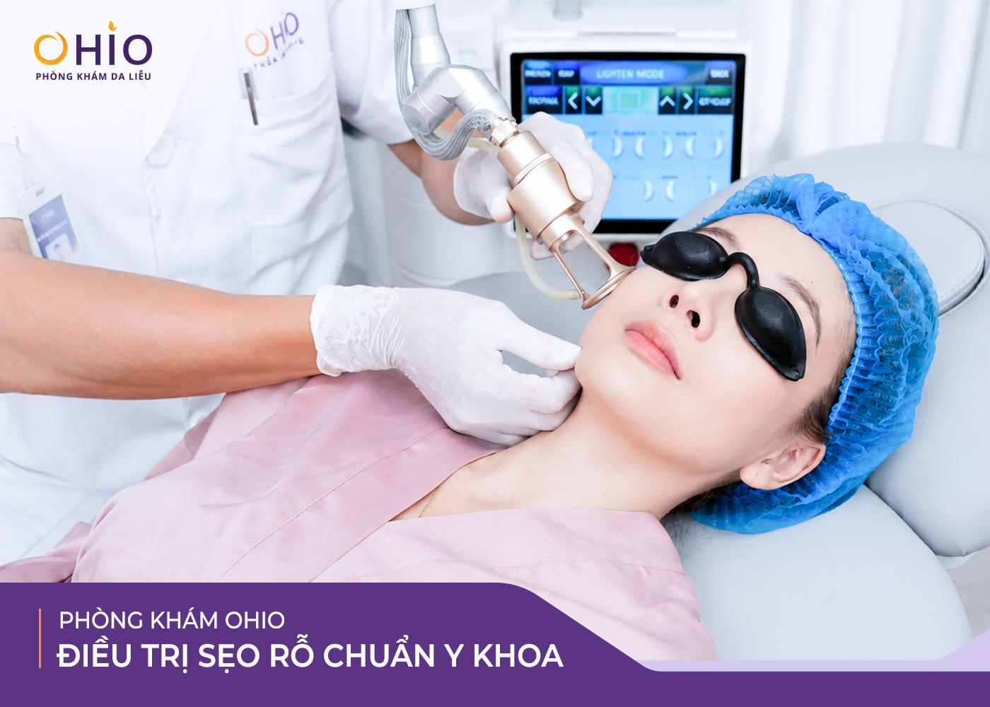 OHIO Và Hướng Đi Mới Trong Điều Trị Sẹo Rỗ: Không Chỉ Làm Đầy Sẹo, Mà Tái Sinh Sự Tự Tin - Phòng khám da liễu OHIO OHIO Và Hướng Đi Mới Trong Điều Trị Sẹo Rỗ: Không Chỉ Làm Đầy Sẹo, Mà Tái Sinh Sự Tự Tin