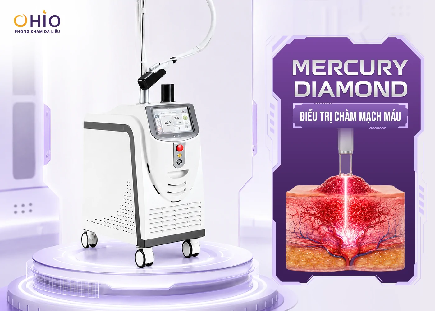 U Máu Là Gì? Dấu Hiệu Nhận Biết, Nguyên Nhân Và Phương Pháp Điều Trị Hiện Nay - Phòng khám da liễu OHIO U Máu Là Gì? Dấu Hiệu Nhận Biết, Nguyên Nhân Và Phương Pháp Điều Trị Hiện Nay