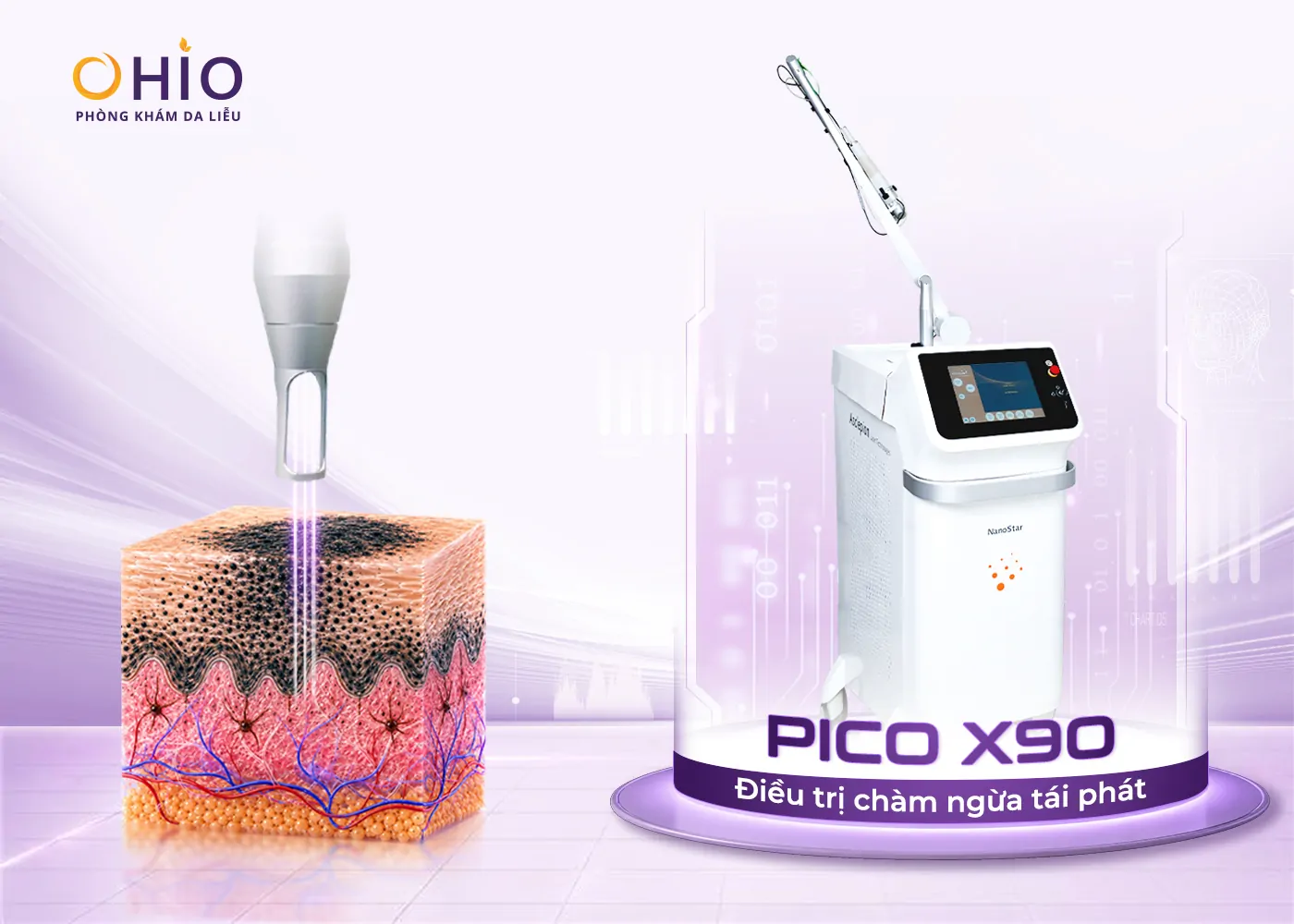 Chàm bớt OTA là gì? Nguyên nhân hình thành và phương pháp điều trị hiện nay - Phòng khám da liễu OHIO Chàm bớt OTA là gì? Nguyên nhân hình thành và phương pháp điều trị hiện nay