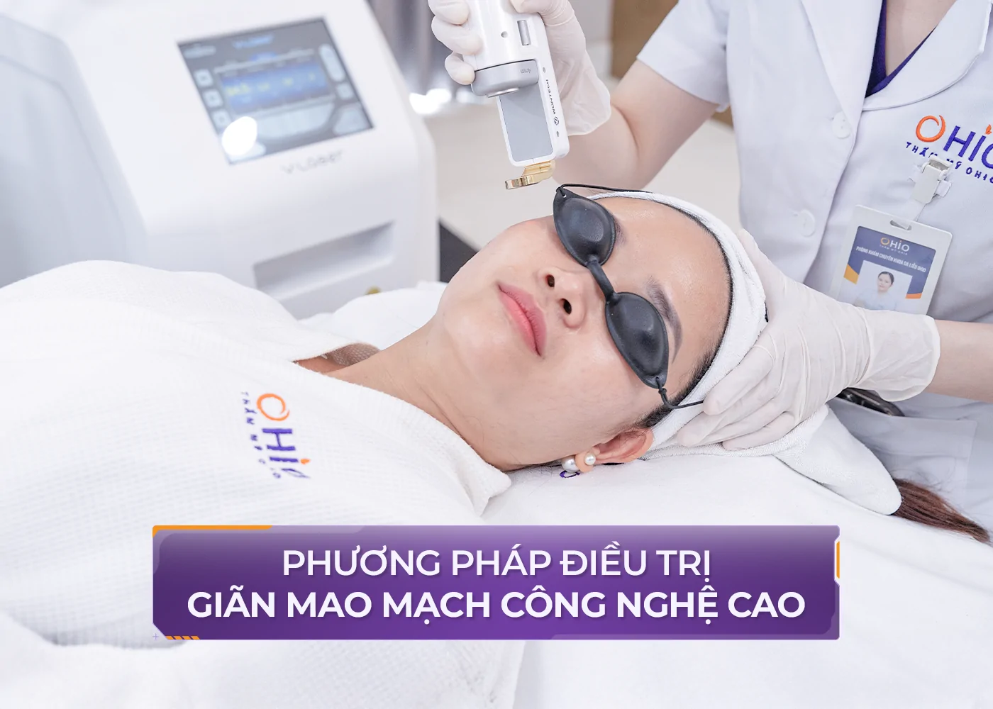Giãn mao mạch ở mặt: Nguyên nhân, dấu hiệu và phương pháp điều trị hiệu quả - Phòng khám da liễu OHIO Giãn mao mạch ở mặt: Nguyên nhân, dấu hiệu và phương pháp điều trị hiệu quả