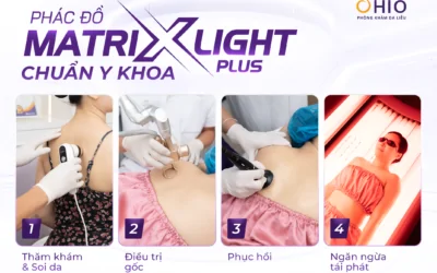Viêm lỗ chân lông nguyên nhân do đâu? Điều trị phương pháp nào hiệu quả nhanh chóng? - Phòng khám da liễu OHIO Viêm lỗ chân lông nguyên nhân do đâu? Điều trị phương pháp nào hiệu quả nhanh chóng?