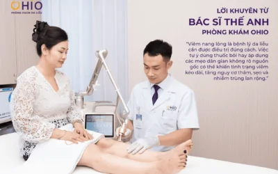 Viêm Nang Lông Có Chữa Dứt Điểm Được Không? 4 Yếu Tố Quyết Định - Phòng khám da liễu OHIO Viêm Nang Lông Có Chữa Dứt Điểm Được Không? 4 Yếu Tố Quyết Định
