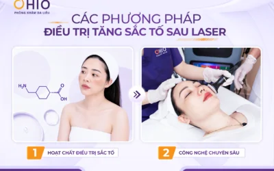 Tăng sắc tố sau laser: Vì sao da thâm sạm hơn sau điều trị và làm thế nào để khắc phục? - Phòng khám da liễu OHIO Tăng sắc tố sau laser: Vì sao da thâm sạm hơn sau điều trị và làm thế nào để khắc phục?