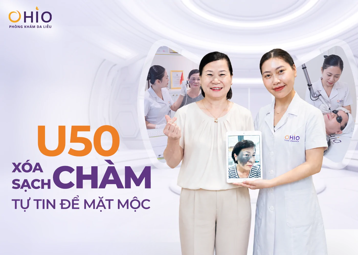 Xóa chàm bớt, U50 tạm biệt khẩu trang tự tin để mặt mộc - Phòng khám da liễu OHIO Xóa chàm bớt, U50 tạm biệt khẩu trang tự tin để mặt mộc