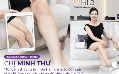 Viêm Nang Lông Có Chữa Dứt Điểm Được Không? 4 Yếu Tố Quyết Định - Phòng khám da liễu OHIO Viêm Nang Lông Có Chữa Dứt Điểm Được Không? 4 Yếu Tố Quyết Định