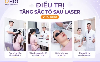 Tăng sắc tố sau laser: Vì sao da thâm sạm hơn sau điều trị và làm thế nào để khắc phục? - Phòng khám da liễu OHIO Tăng sắc tố sau laser: Vì sao da thâm sạm hơn sau điều trị và làm thế nào để khắc phục?